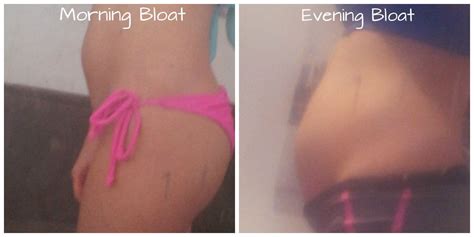 How I Banished the Bloat! Before and After Pics!