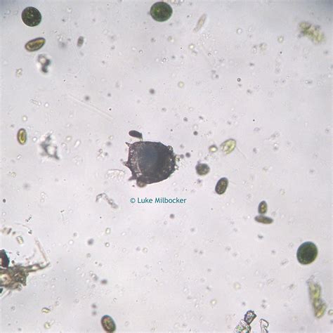 Microscopy Protozoans | Microbus Microscope Educational Website