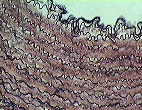 Elastic Connective Tissue Histology