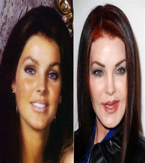 60 Worst Cases Of Celebrity Plastic Surgery Gone Wrong