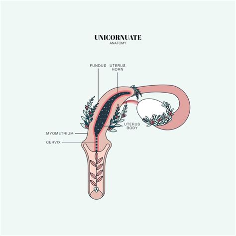 Unicornuate Uterus - Designs by Duvet Days Anatomy Illustrations | Human anatomy art ...