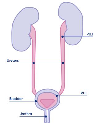 Baby—kidney pelvis dilatation - Patient Information Brochures - Mater Group