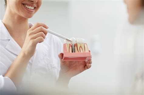 Diente o muela nuevos: Consejos para cuidar el implante dental – Ribera ...