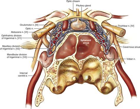 Sphenoid Sinus Cerebrospinal Fluid Leak and Encephalocele Repair | Ento Key