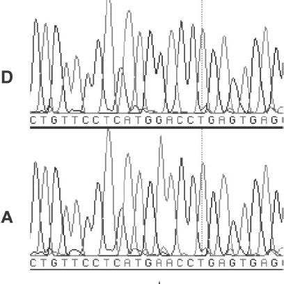 Electrophoretogram of sequencing analysis. ‘‘D’’ and ‘‘A’’ designate... | Download Scientific ...