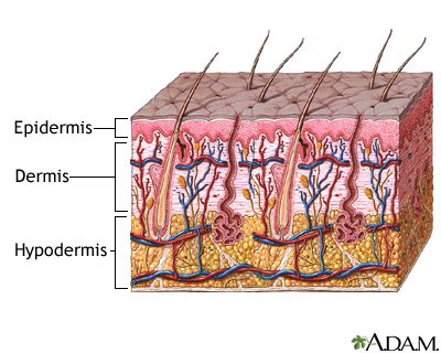 Skin layers: MedlinePlus Medical Encyclopedia Image