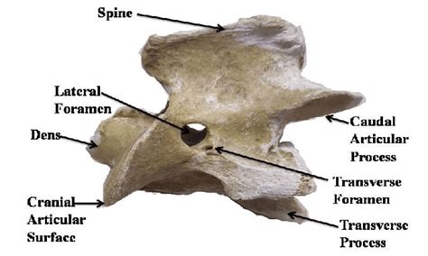 Cervical Vertebrae Lateral View Labeled