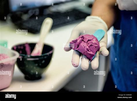 Dental alginate impression hi-res stock photography and images - Alamy