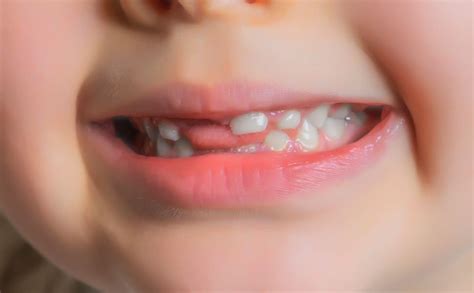 Baby Teeth Myths—Busted! - Morristown Pediatric Dentistry