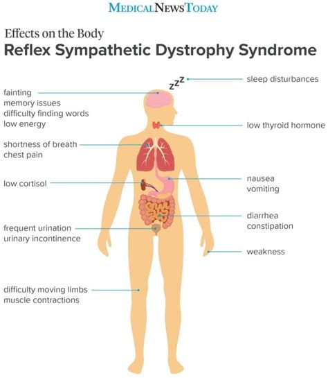 What to know about RSD | Member Learning Community