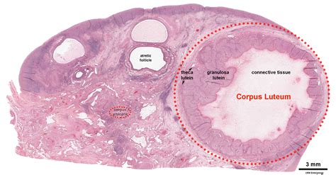 File:Ovary corpus luteum.jpg - Embryology