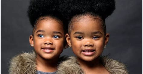 The twins attracted a lot of attention thanks to their appearance like famous singer Rihanna and ...