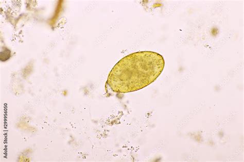 Egg of intestinal fluke in human stool, analyze by microscope, original ...