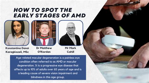 How to Spot the Early Stages of AMD - Irish Pharmacy News