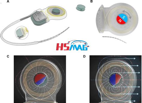 Cochlear Implant (CI) Magnet - Magnets By HSMAG