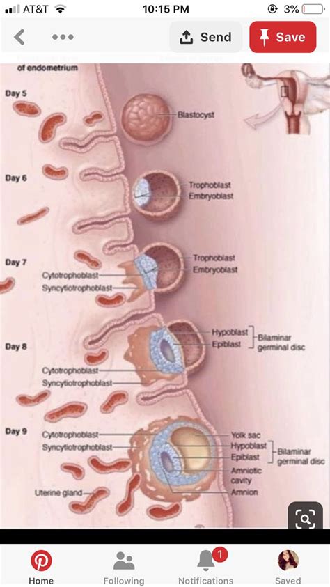 Pin on IVF