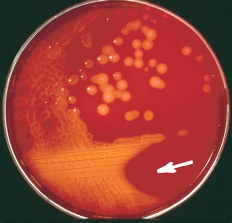 Streptococcus Pyogenes (GAS): Characteristics, Diseases, Tests ...