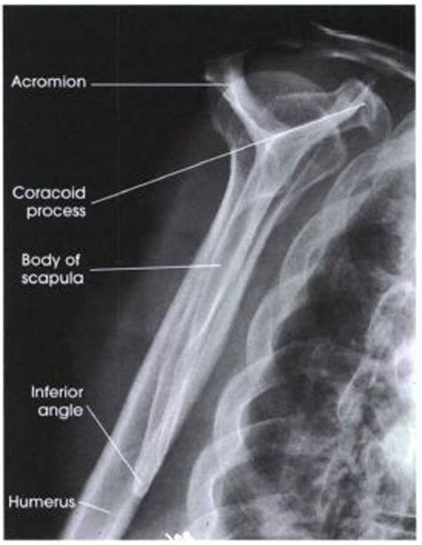 Pin on Radiology