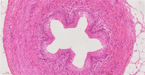 Human Ureter cross-section histology slides, 7 µm sec., H&E Stain, human histology slides ...