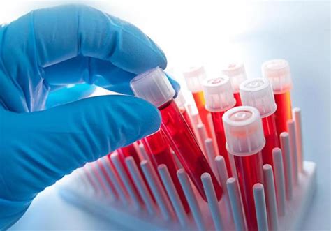 Hematology Market Newest Forecast Insights by 2031 on Key