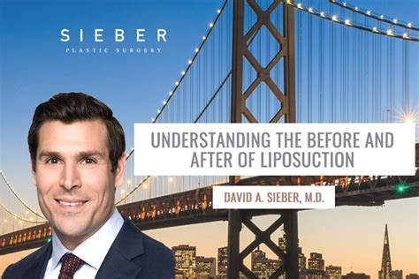 Understanding Liposuction Results Before and After | Sieber Plastic Surgery