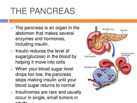 Insulinoma slideshow