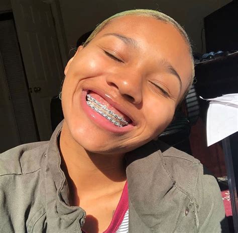 The Best Best Color Braces For Brown Skin References