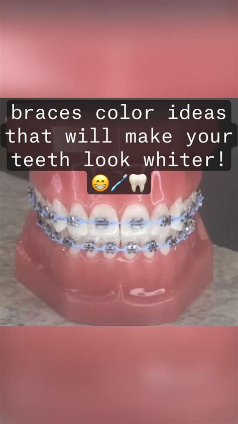 braces color ideas that will make your teeth look whiter! 😁🪥🦷 | Braces ...