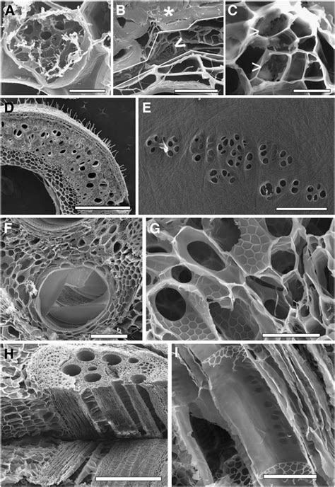 Plant Cells Under An Electron Microscope