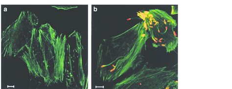 Shigella F-actin comet tail formation in HeLa cells treated with ...