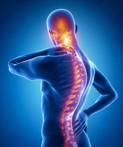 Facet Joint Pain - SOL Physical Therapy