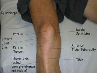 Knee examination