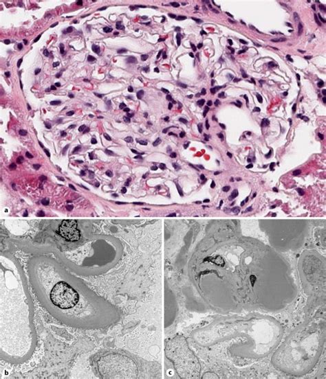 a Light microscopy. Photomicrograph of a representative glomerulus... | Download Scientific Diagram