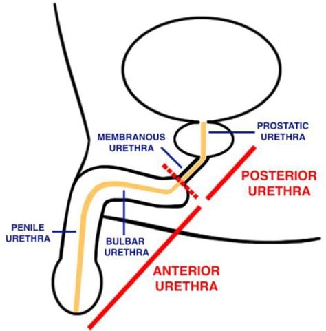 Fluoroscopy And Urethral Anatomy