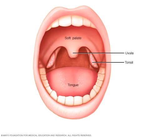 Tonsil cancer - Symptoms and causes - Mayo Clinic