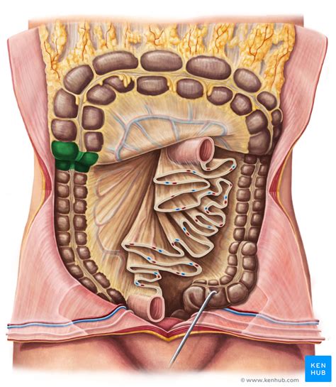 Abdominal Cavity: Infracolic Compartment - Anatomy | Kenhub