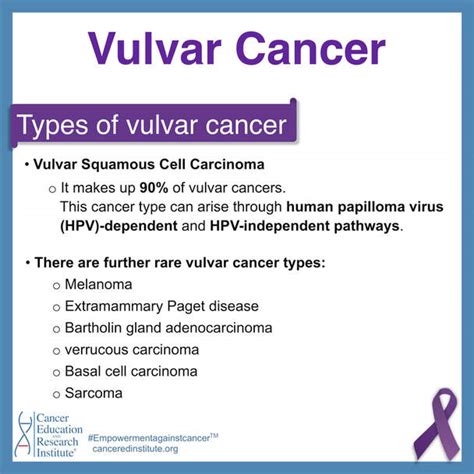 Vulvar Cancer Stages