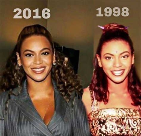 Beyonce Plastic Surgery: Boob Job, Nose Job, Liposuction, Teeth