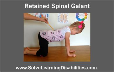 Retained Spinal Galant Reflex | Solve Learning Disabilities