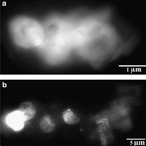 Intermediates of large-scale chromatin condensation. (a) Chromatin ...