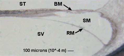 Histologic section from the basal turn of a human cochlea. The basilar ...