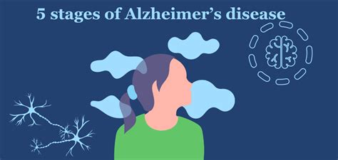 Five stages of Alzheimer's disease