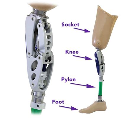 Lower Limb Prosthesis 101: Knowledge is Power - Sheltering Arms Institute