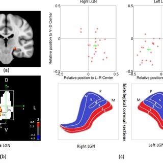 LGN definition and spatial analysis of top 20% activated voxels in LGN ...