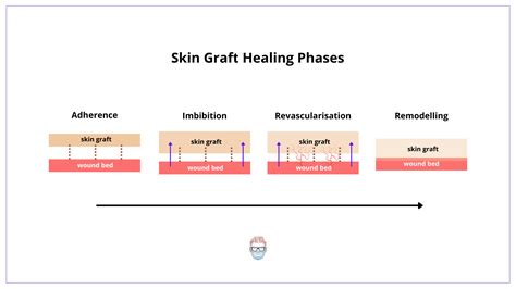 Skin Grafts