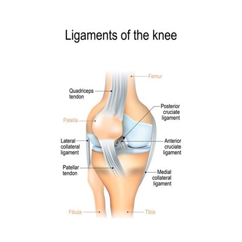 Knee Sprain - Harvard Health