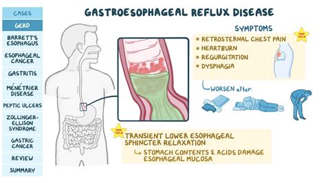 GERD, peptic ulcers, gastritis, and stomach cancer: Pathology review | Osmosis