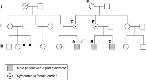 Pedigree Alport Syndrome X-linked. | Download Scientific Diagram