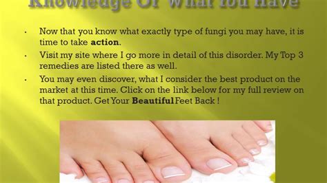 Yellow Toenail Remedies - How To Cure Yellow Toenails - YouTube