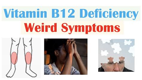 Vitamin B12 Deficiency, Causes, Signs, Symptoms, Diagnosis,